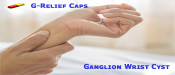 Ganglion SURGERY Alternative G-Relief Caps. INFO www.g-relief.com